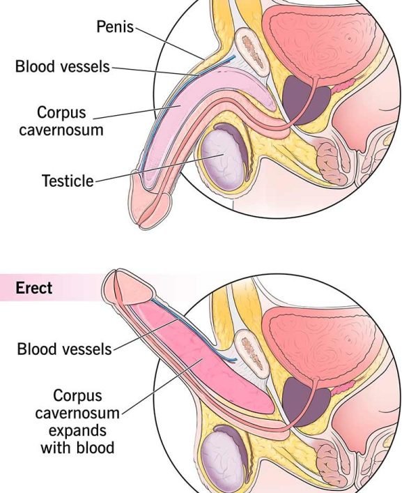 10035-erectile-dysfunction-1-600x707-1
